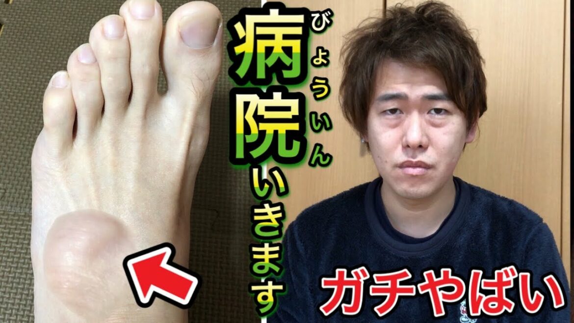 【手術するかも】足のしこりがどんどん大きくなっていくので病院に行ったら信じられないことを言われました…