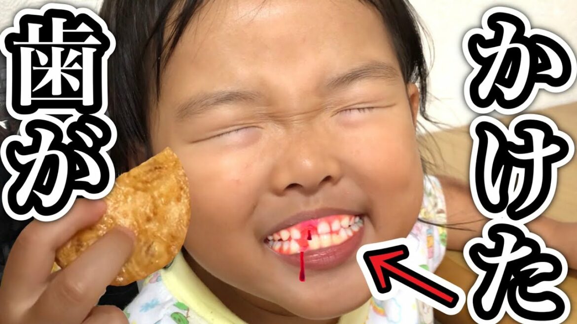 ※ここちゃんの歯が2本かけました…