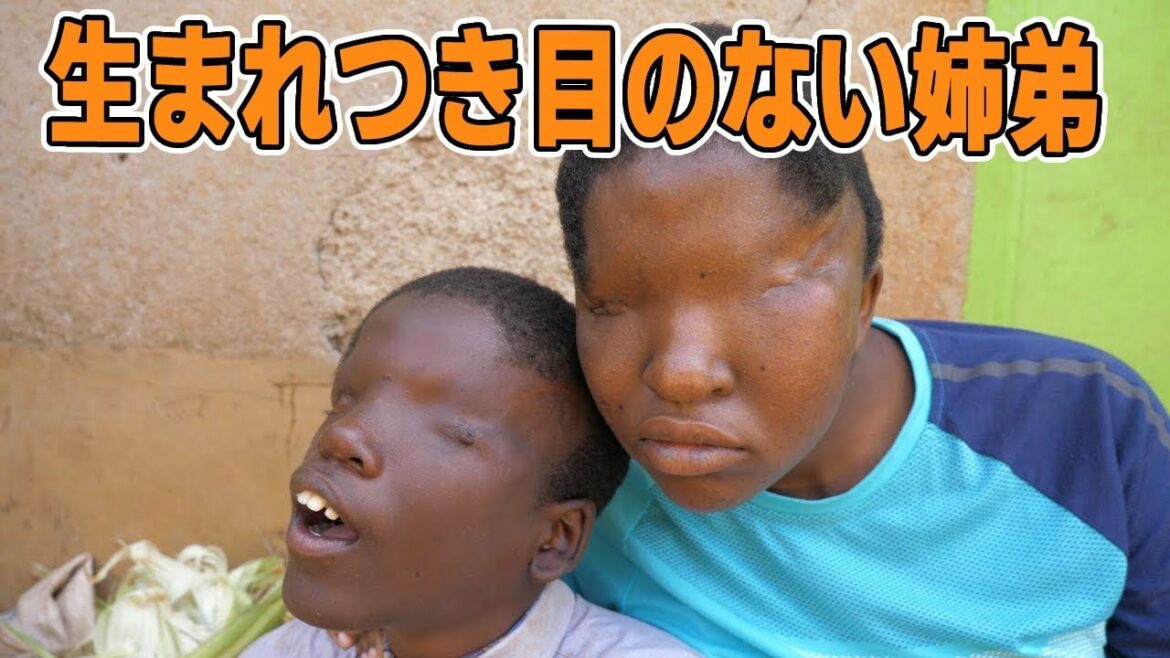 生まれつき目のない姉弟。支え合って生きる感動ストーリー