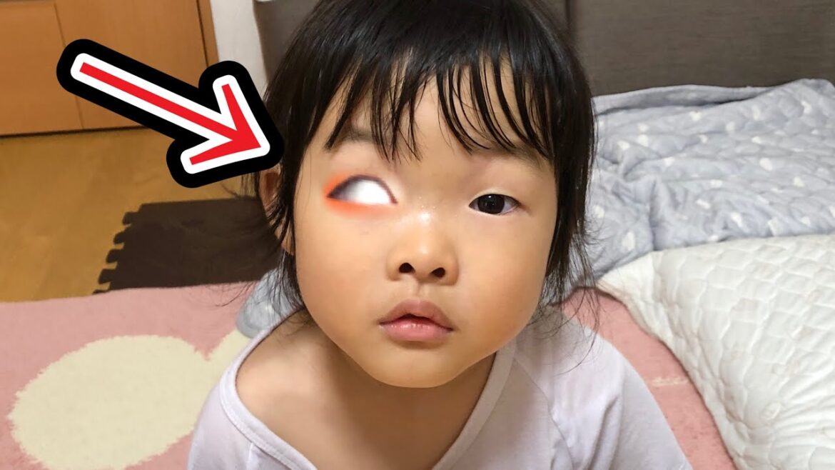 ここちゃん右目どうしたの?????