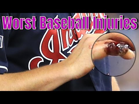 最悪の野球負傷 9