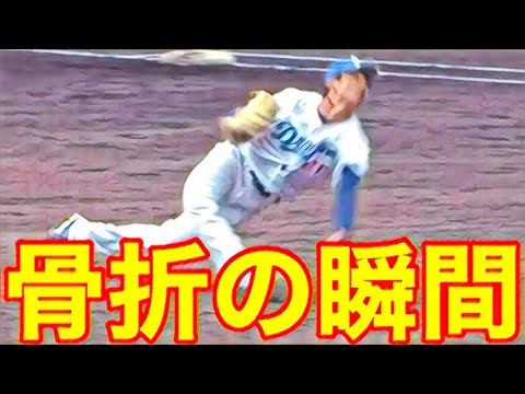 【中日】岡田俊哉　骨折の瞬間‼️（負傷交代　プロ野球ニュース　右足　楽天　中日ドラゴンズ　ハイライト）
