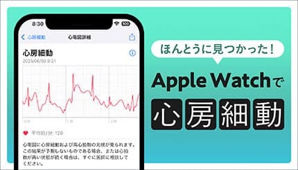 Apple WatchのCMの「心房細動」が見つかって手術!入院中を快適に過ごすには? – BCN+R Apple WatchのCMの「心房細動」が見つかって手術!入院中を快適に過ごすには? - BCN+R