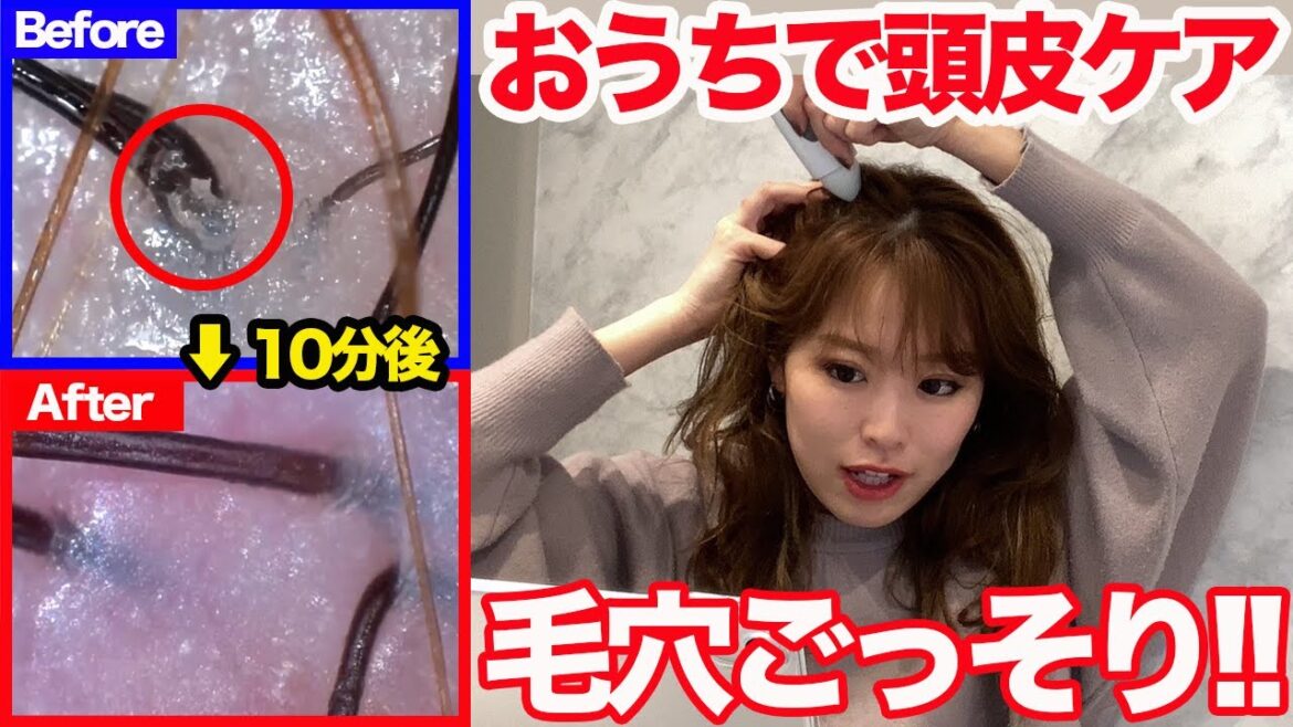 【毛穴汚れ】頭皮の汚れをお家で簡単に落とす裏技！白髪や抜け毛、頭皮のにおいも改善！