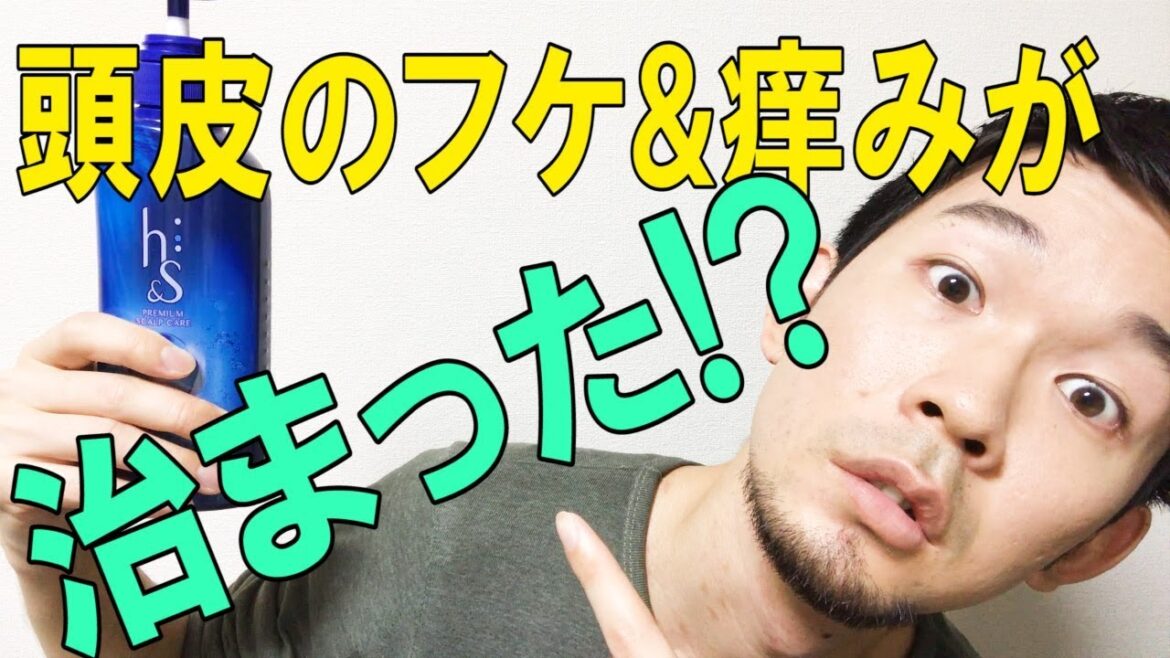 【感動】フケ&痒みが治まった!h&s シャンプー モイスチャー 【感動】フケ&痒みが治まった!h&s シャンプー モイスチャー
