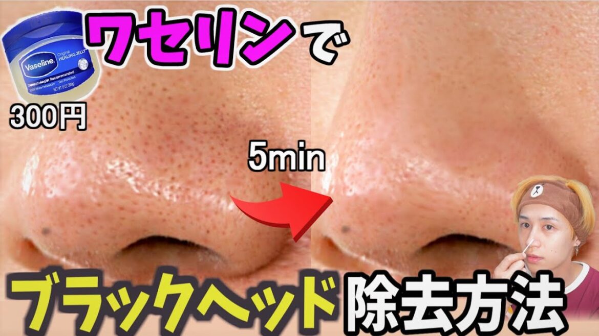 ワセリンを使って5分で毛穴ブラックヘッドを無くす方法! Black head remover Vaseline. ワセリンを使って5分で毛穴ブラックヘッドを無くす方法! Black head remover Vaseline.