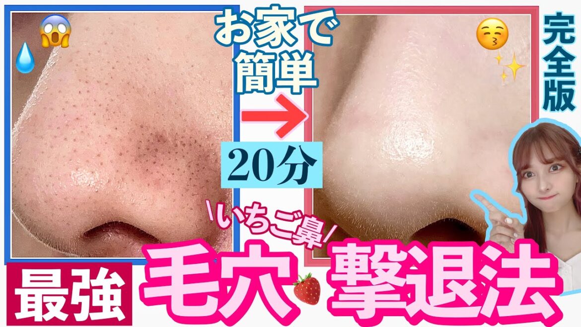 【神回】１日でいちご鼻を抹殺した最強毛穴特別スキンケア！！！！！￥2000円以下！ドラックストア！【Qoo10】