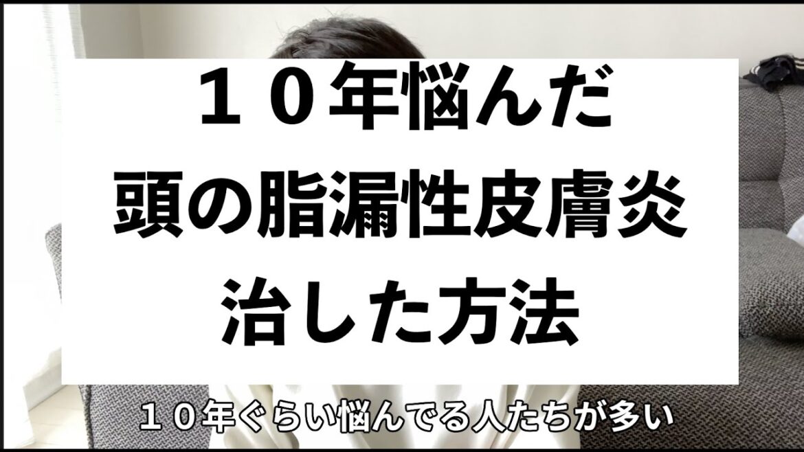 脂漏性皮膚炎が根本的に治って嬉しい。本気で１０年悩みましたついでにハゲ予防