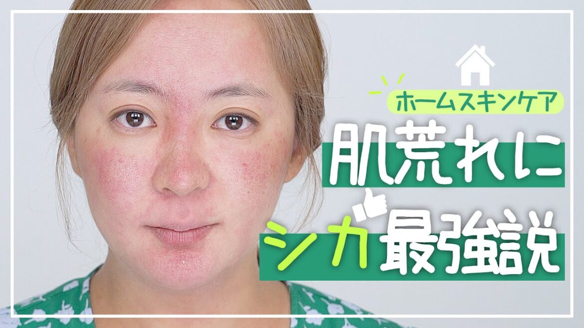 荒れた肌🍀3日間🦌シカ🦌でスキンケアしてみたら、こうなった