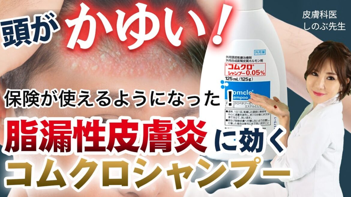 【頭が痒い！脂漏性皮膚炎にお悩みの方に朗報！】皮膚科医が勧めるコムクロシャンプー 保険適用になりました