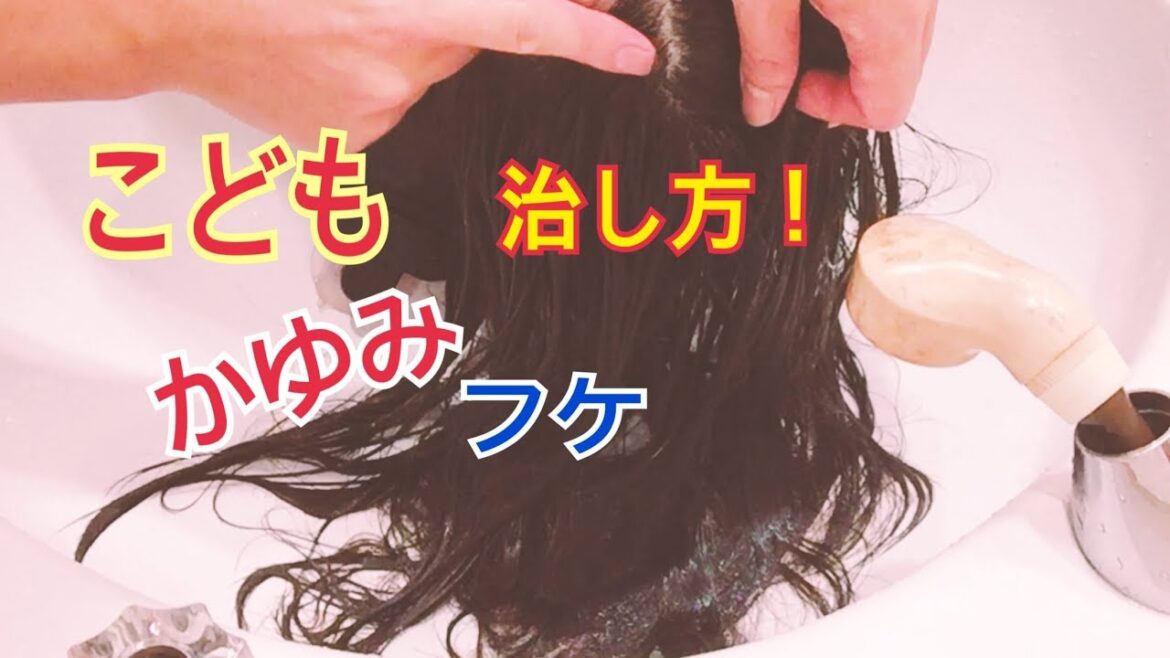 子供フケ、かゆみのシャンプーの2ヶ条！対策、やり方！エイチゼロワン