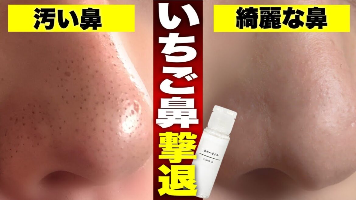 【角栓】ホホバオイルで鼻の黒ずみマジ取れるから使ってみてくれ… 【角栓】ホホバオイルで鼻の黒ずみマジ取れるから使ってみてくれ...