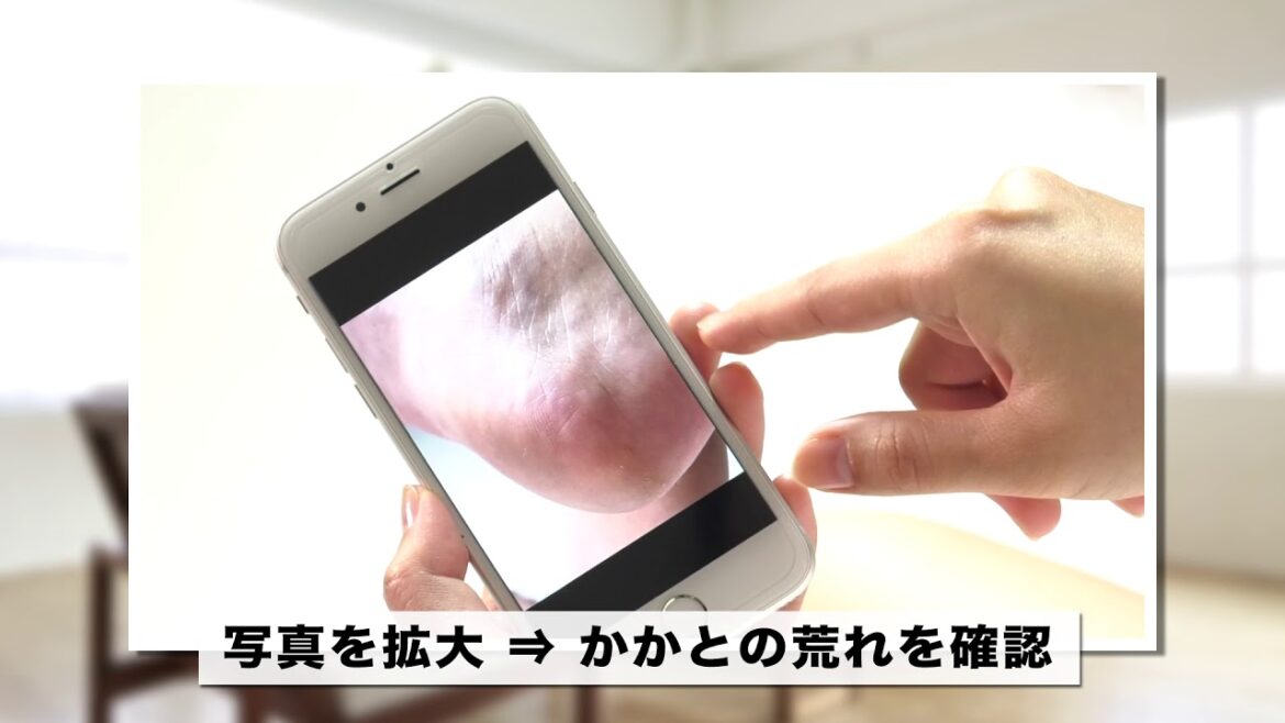 かかとの荒れに気がつくフットセルフィー【ユースキン製薬】