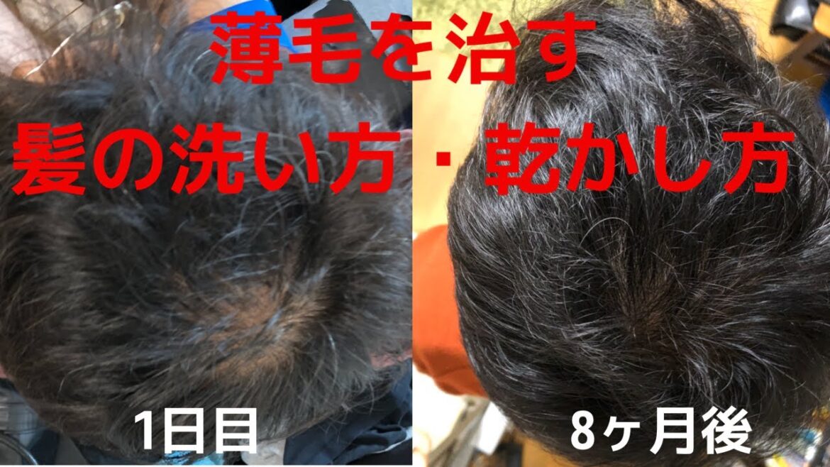 薄毛を治す洗い方・乾かし方