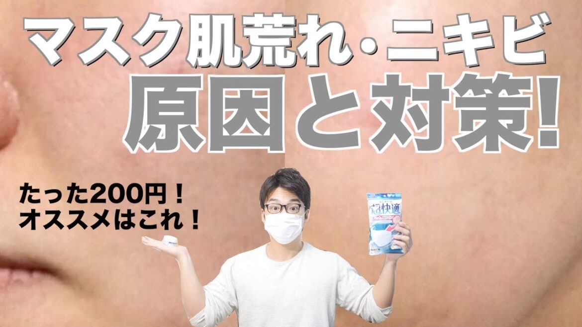 【超簡単】マスクによる正しいニキビ・肌荒れ対策を教えます！