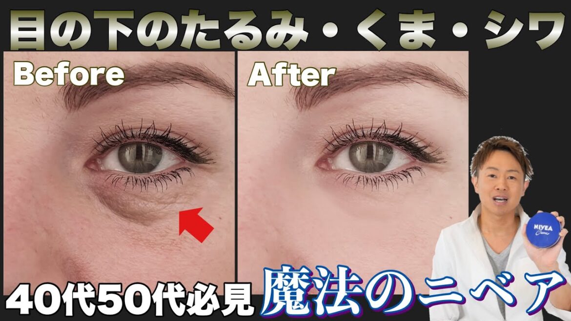 目の下のたるみ！目のシワ！目のクマはニベアでマッサージ！！