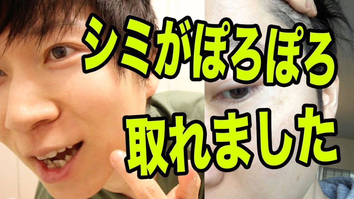 シミがぽろぽろ取れました!ひまし油の凄い効果 シミがぽろぽろ取れました!ひまし油の凄い効果