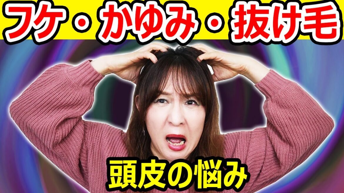 フケ、かゆみ、抜け毛、本気で悩んでる人へ ←ミノン駄目だった人も!(私はこれで治った) フケ、かゆみ、抜け毛、本気で悩んでる人へ ←ミノン駄目だった人も!(私はこれで治った)