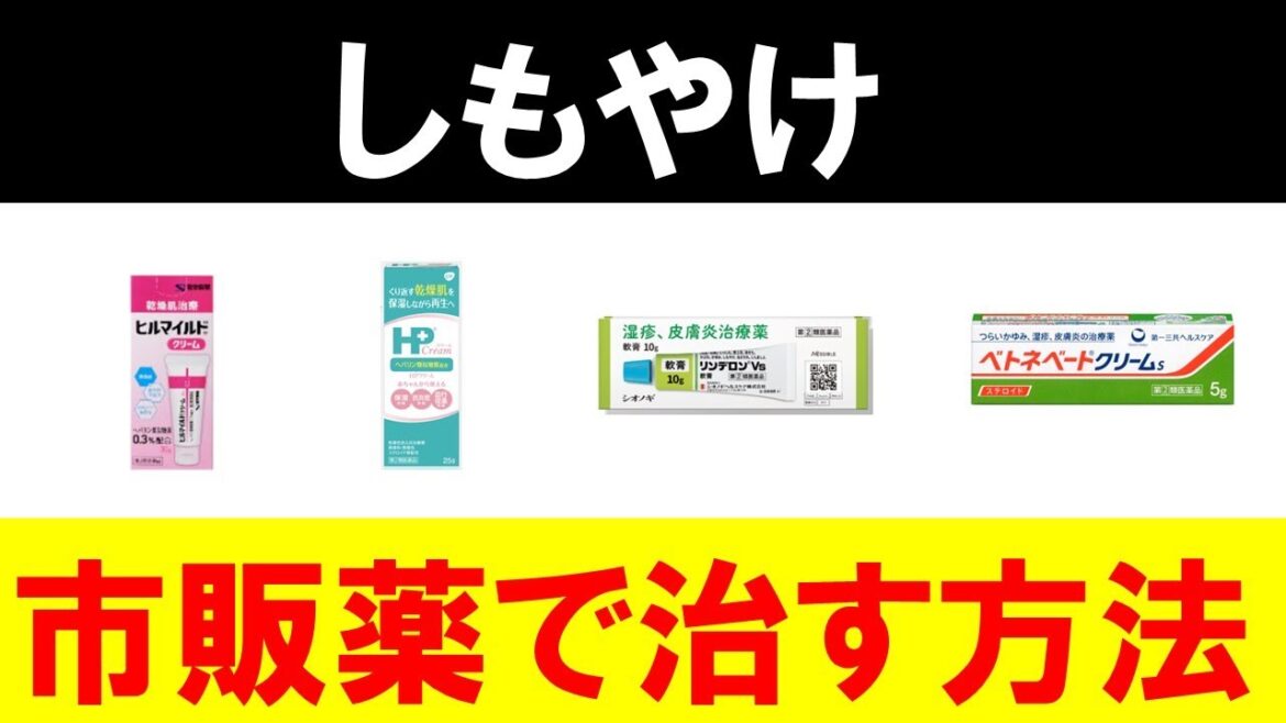 【しもやけ】市販薬を使った最強の治し方を紹介します