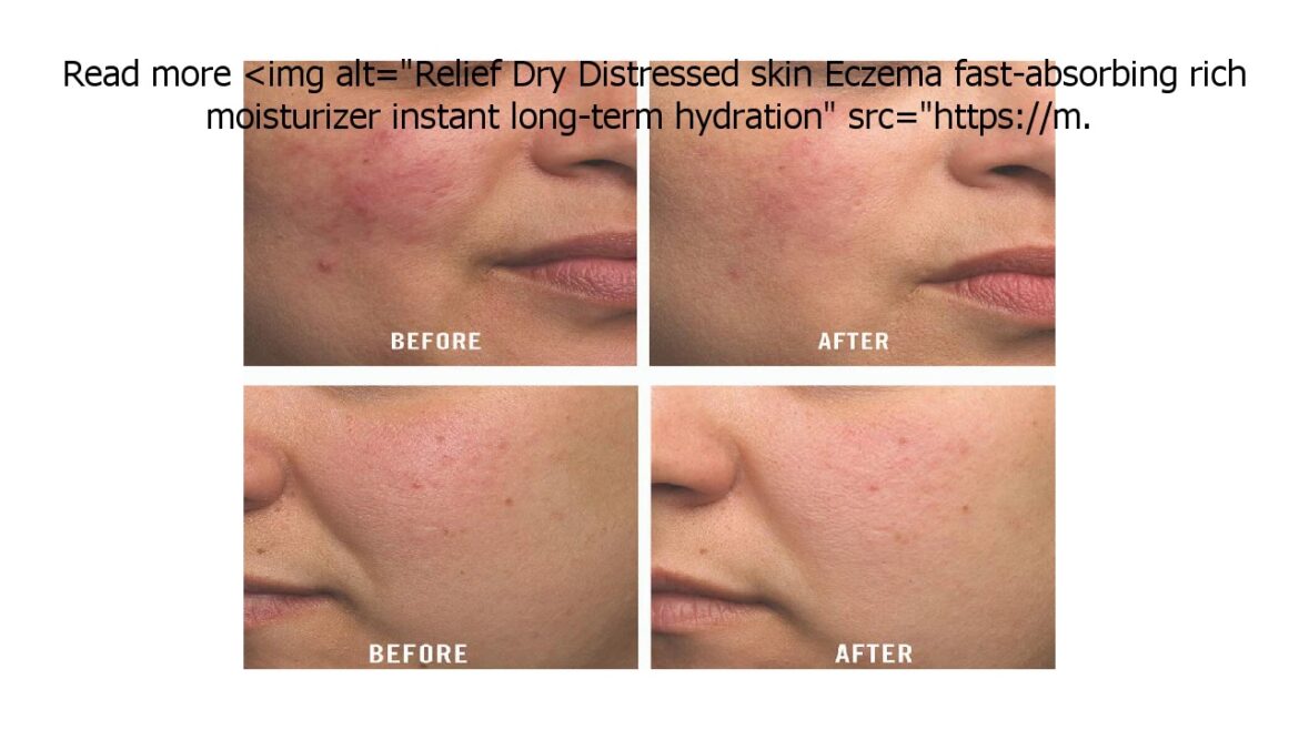 Special Discount on First Aid Beauty Ultra Repair Cream, Intense Hydration, 14 oz Original
