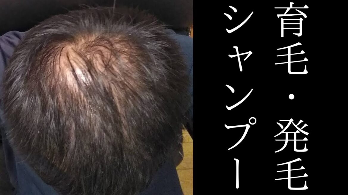 【育毛・発毛シャンプー】頭皮の汚れをしっかり落とす。ボタニカルシャンプー ＆重曹石鹸【AGA・薄毛・若ハゲ・M字ハゲ・円形脱毛症】フォリックスFR１２