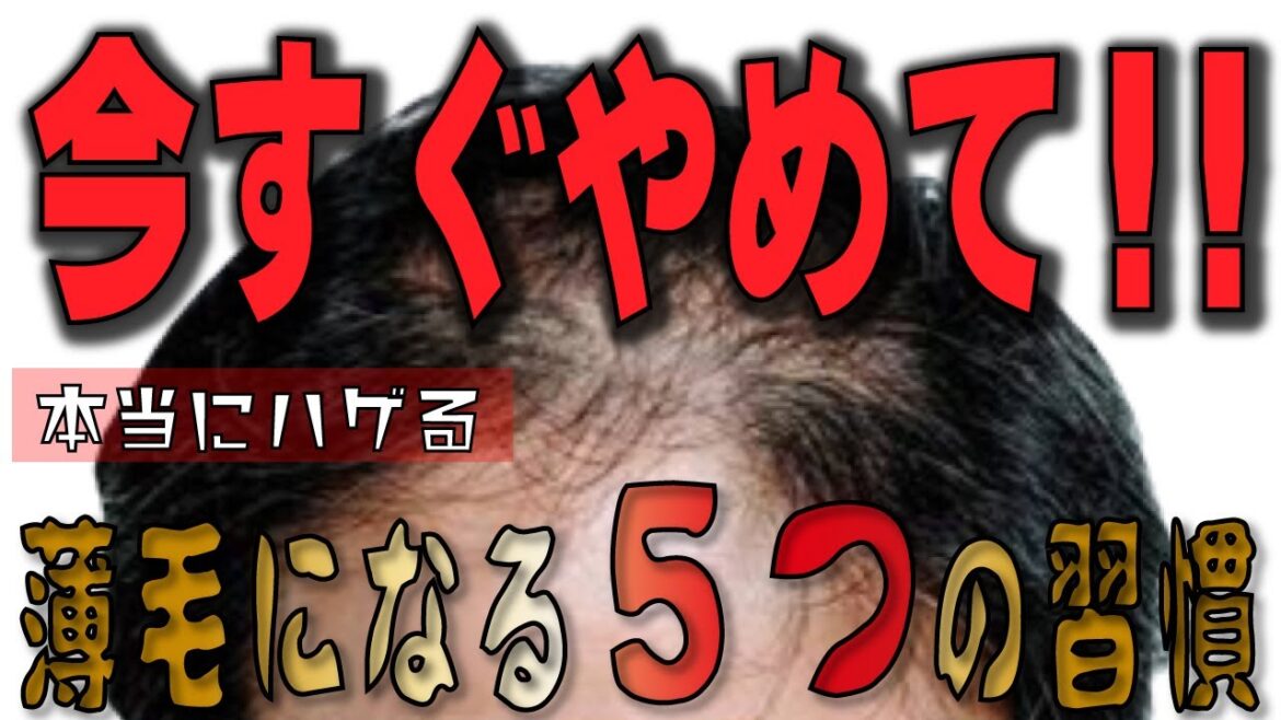 ハゲ予防!絶対にダメ!薄毛になりやすい習慣TOP5!皆やってます… 対策/改善/シャンプー ハゲ予防!絶対にダメ!薄毛になりやすい習慣TOP5!皆やってます… 対策/改善/シャンプー