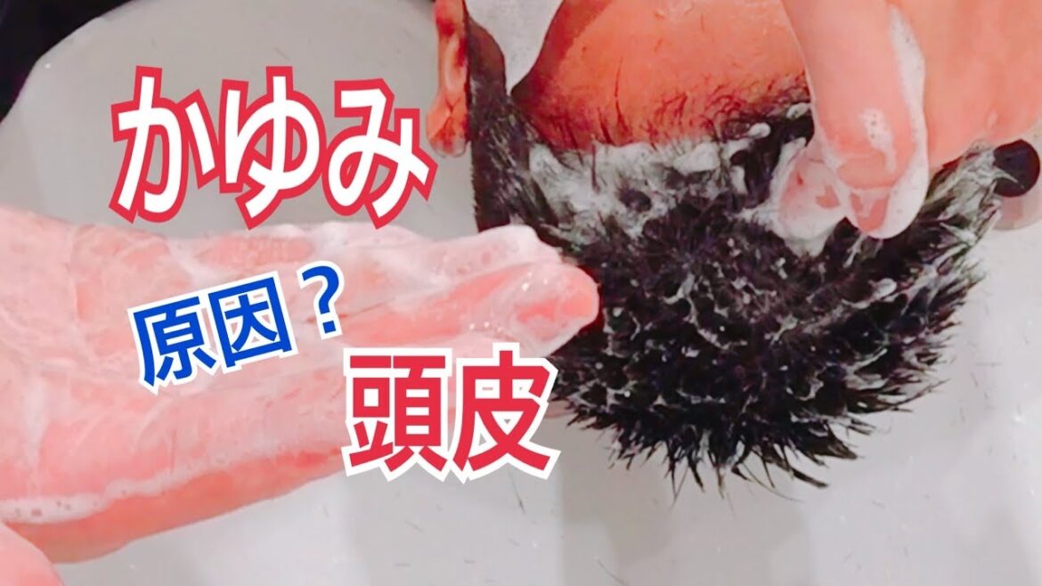 頭皮のかゆみ原因！プロが教える！シャンプーのやり方！hairstyle