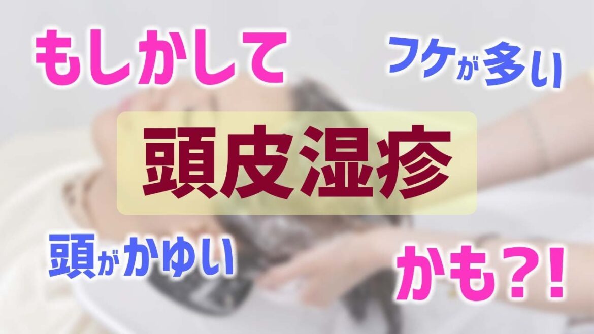 頭皮湿疹の治し方【コムクロシャンプーのメリット】