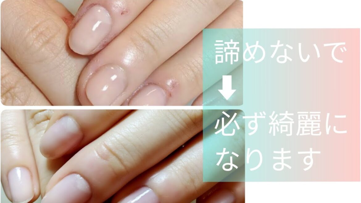 指周りの手あれ、諦めないで…Vol.50