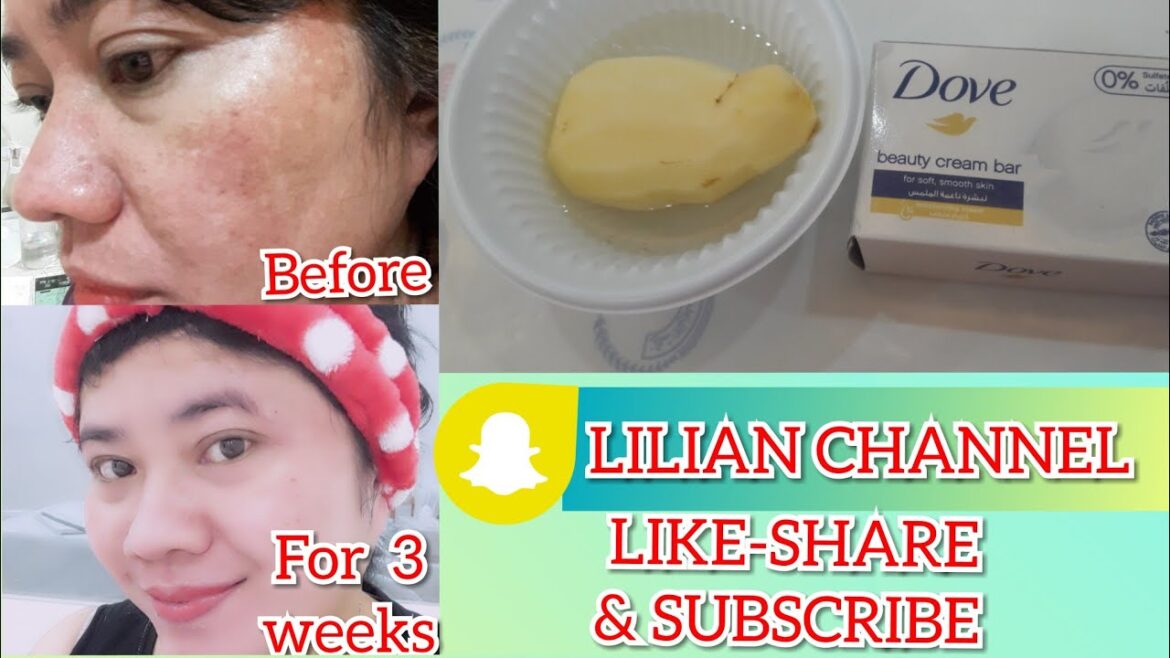 "How to achieved white ,fairer,glowing  skin using Dove soap and a Potato?"/Home Remedies/