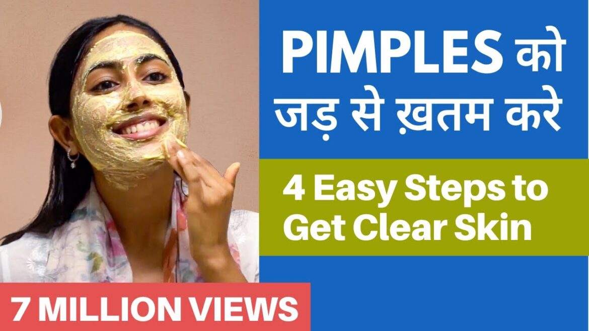 PIMPLES को बोलो Goodbye | It's time to get CLEAR & SPOTLESS SKIN! PIMPLES को बोलो Goodbye | It's time to get CLEAR & SPOTLESS SKIN!