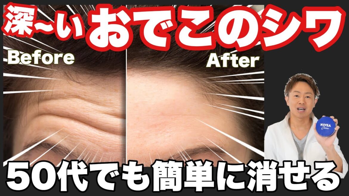 【90秒ニベアマッサージ】深いおでこのしわがこれなら消せます！