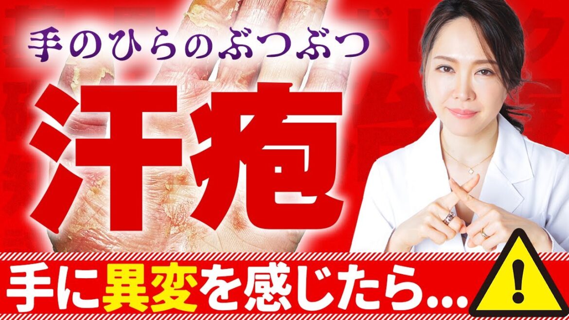 【手がかゆい】そのぶつぶつはもしかしたら”汗疱”です。原因は〇〇アレルギーであることも、、、（医師解説）
