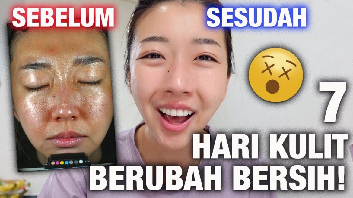 7 HARI CHALLENGE PAKE KRIM KOREA INI DAN HASIL NYA ... COCOK UNTUK KULIT JERAWAT !