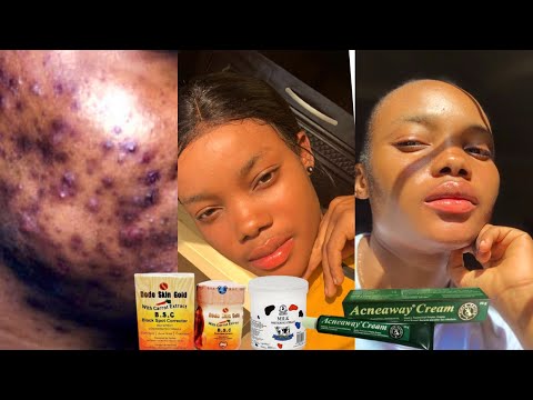 ライトニングフェイスクリームのミックス方法!ドードースキンゴールドダークスポット除去クリーム! ライトニングフェイスクリームのミックス方法!ドードースキンゴールドダークスポット除去クリーム!