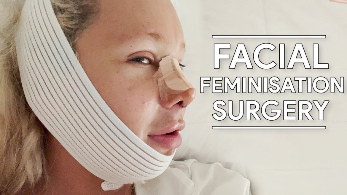私は顔の女性化手術を受けました（Facialteamで）