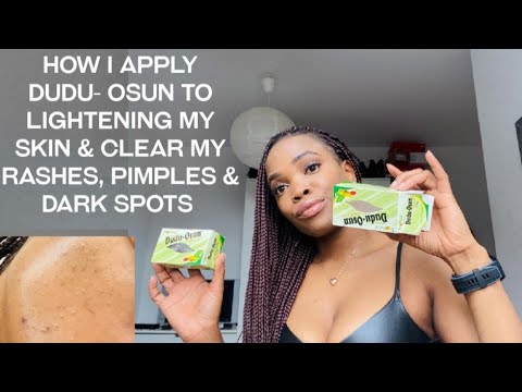 DuDu-Osunを適用して肌を明るくする方法明確な発疹、にきび、ダークスポット/私のレビュー DuDu-Osunを適用して肌を明るくする方法明確な発疹、にきび、ダークスポット/私のレビュー