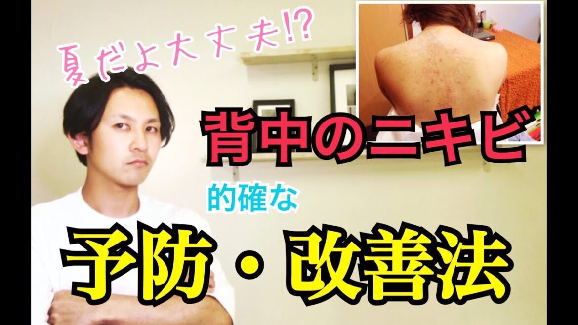 【背中のニキビ】背中のニキビで悩んでる方必見!!!!!予防したい方も!!!!!水着、ウェディングドレス着ても大丈夫???!!