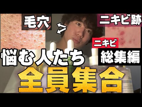 【神回shortじゃできない..】これで分かる❗️❗️毛穴ニキビニキビ跡の商品背全て。(美容液 パック 化粧水編)2022 【神回shortじゃできない..】これで分かる❗️❗️毛穴ニキビニキビ跡の商品背全て。(美容液 パック 化粧水編)2022
