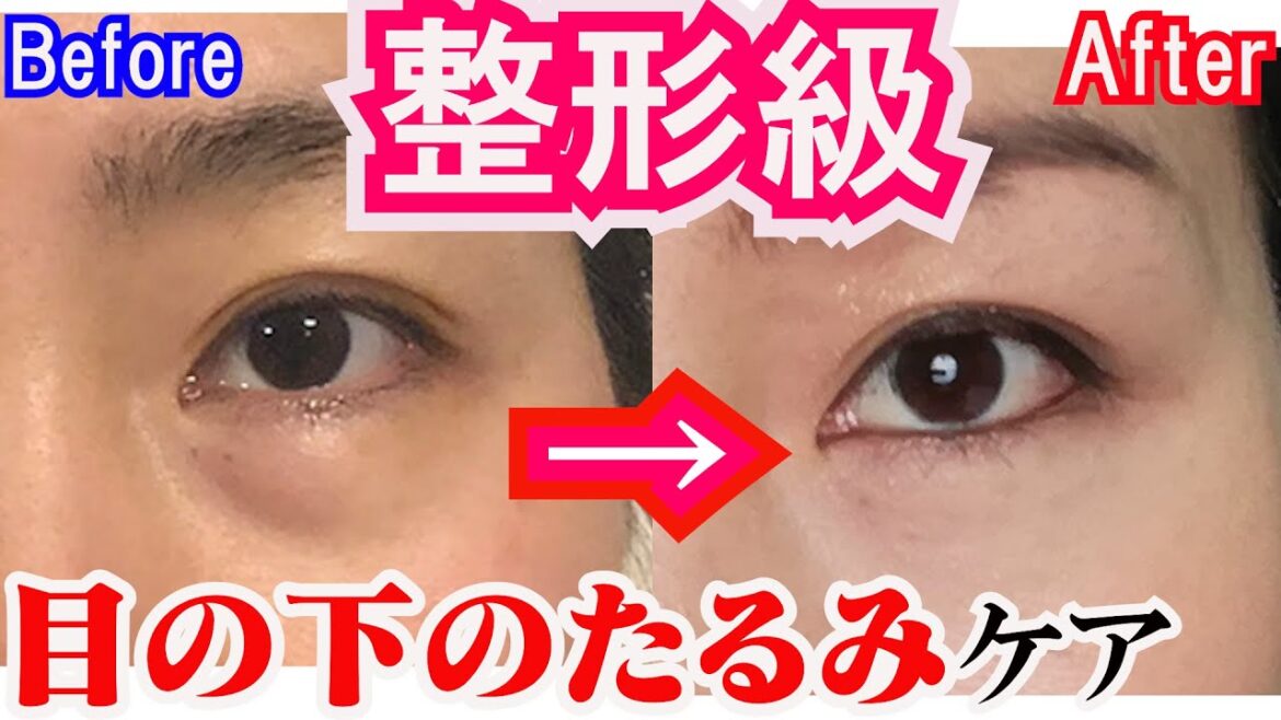【200万再生】1週間で激変！目の下のたるみをとるマッサージ＆エクササイズ夜の美顔ヨガ