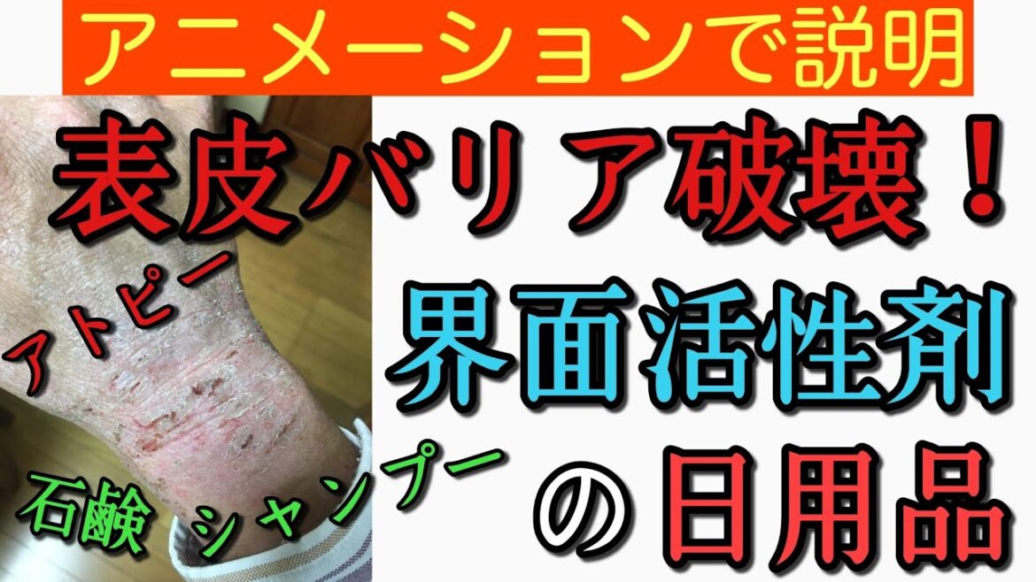 【9分で説明】アトピーの脱ステ中は使うな!界面活性剤! 【9分で説明】アトピーの脱ステ中は使うな!界面活性剤!