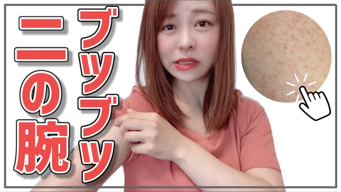 【サメ肌/毛孔性苔癬】原因や対処法まで徹底解説! 【サメ肌/毛孔性苔癬】原因や対処法まで徹底解説!