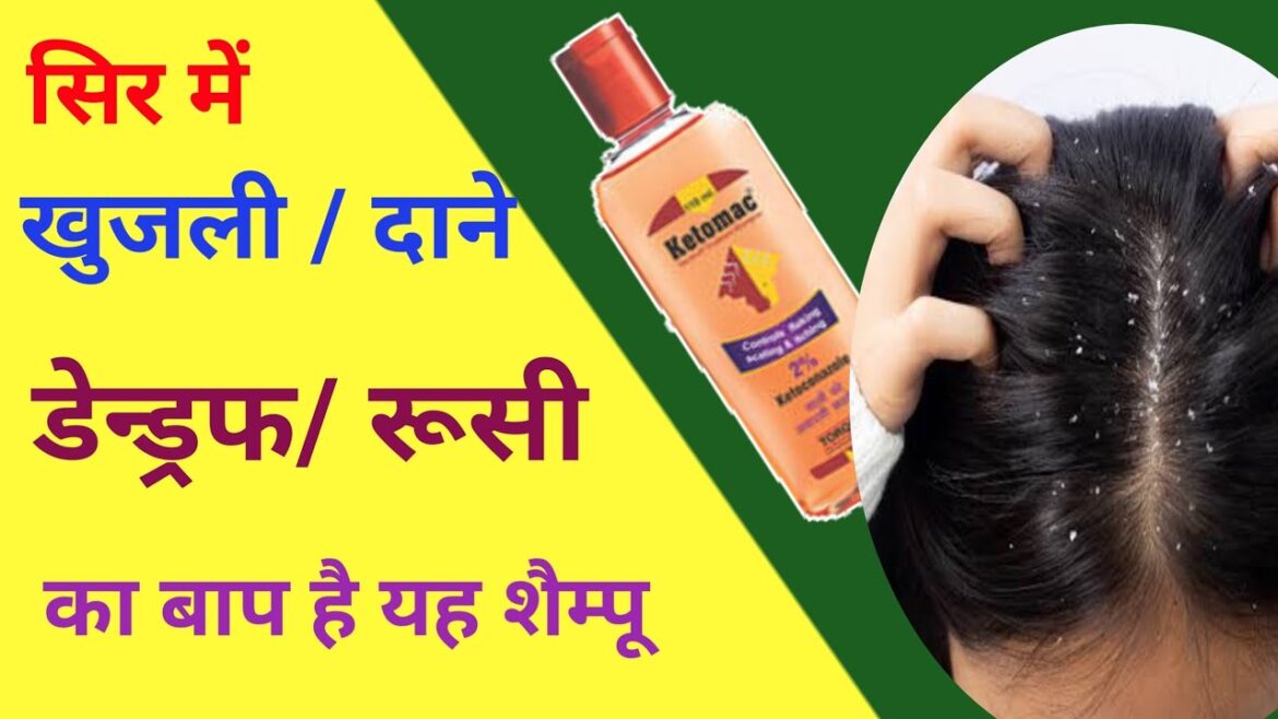 Best antifungal shampoo