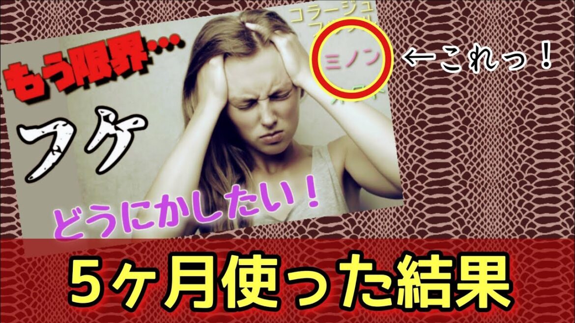 1295日後【考察_7の続き】ミノン（薬用シャンプー）を5ヶ月使った結果…