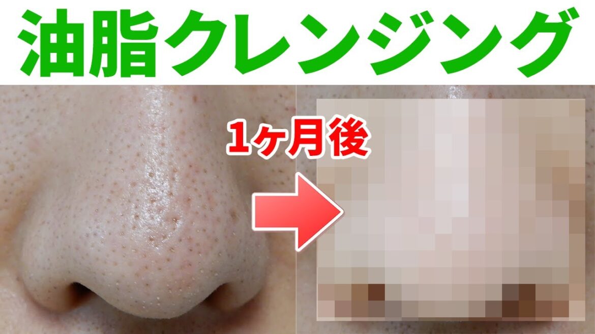 かずのすけさん推奨の油脂クレンジングで鼻の毛穴は改善するのか？1ヶ月試してみた結果！