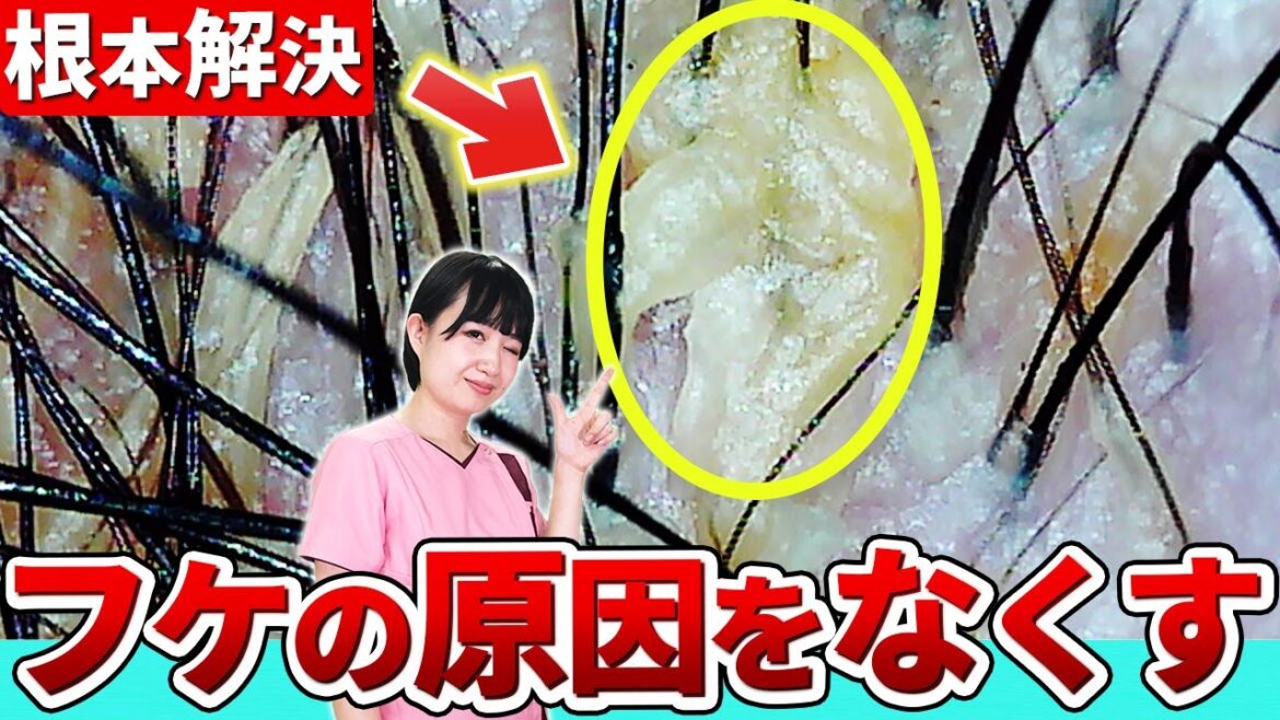 【もう困らない】簡単に出来るシャンプーでフケをなくす方法を発毛のプロが伝授