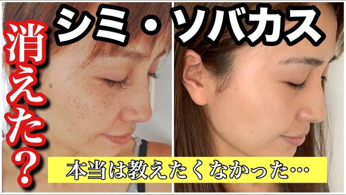 【必見】35歳以上でもシミ・ソバカス顔はキレイになる【アラフォー主婦の実体験】 【必見】35歳以上でもシミ・ソバカス顔はキレイになる【アラフォー主婦の実体験】