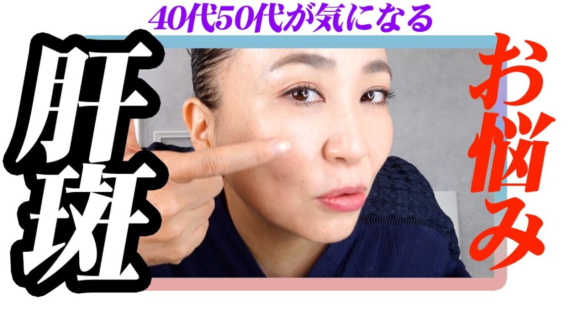 40代50代の悩み シミ・肝斑どうしたらいいの？