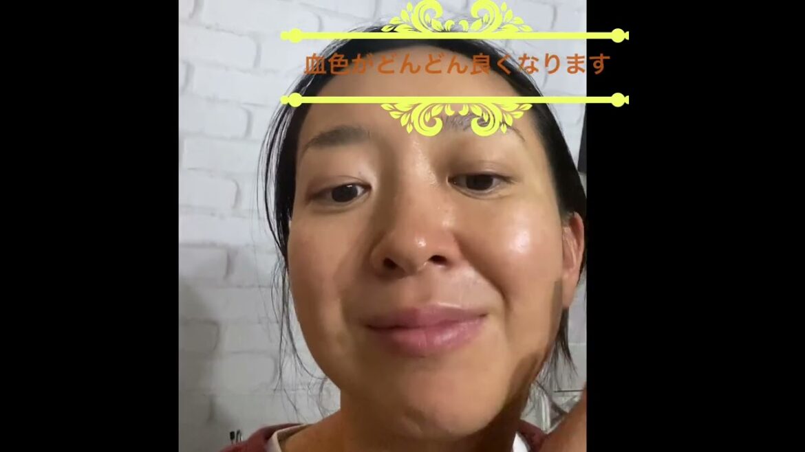 ユースキンの薬効効果❗️使い方を解説