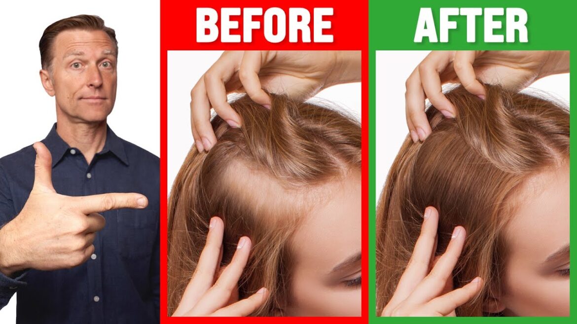 Grow THIN Hair into THICK Hair - Dr. Berg